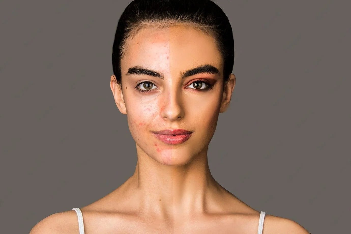 Blemish & Scar Treatment at AZ Esthetics