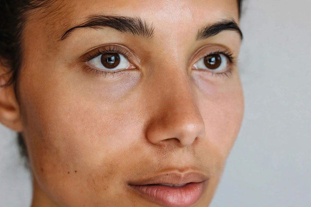 Skin after treatment