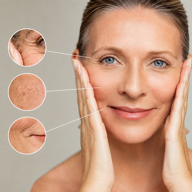 Wrinkles Treatment